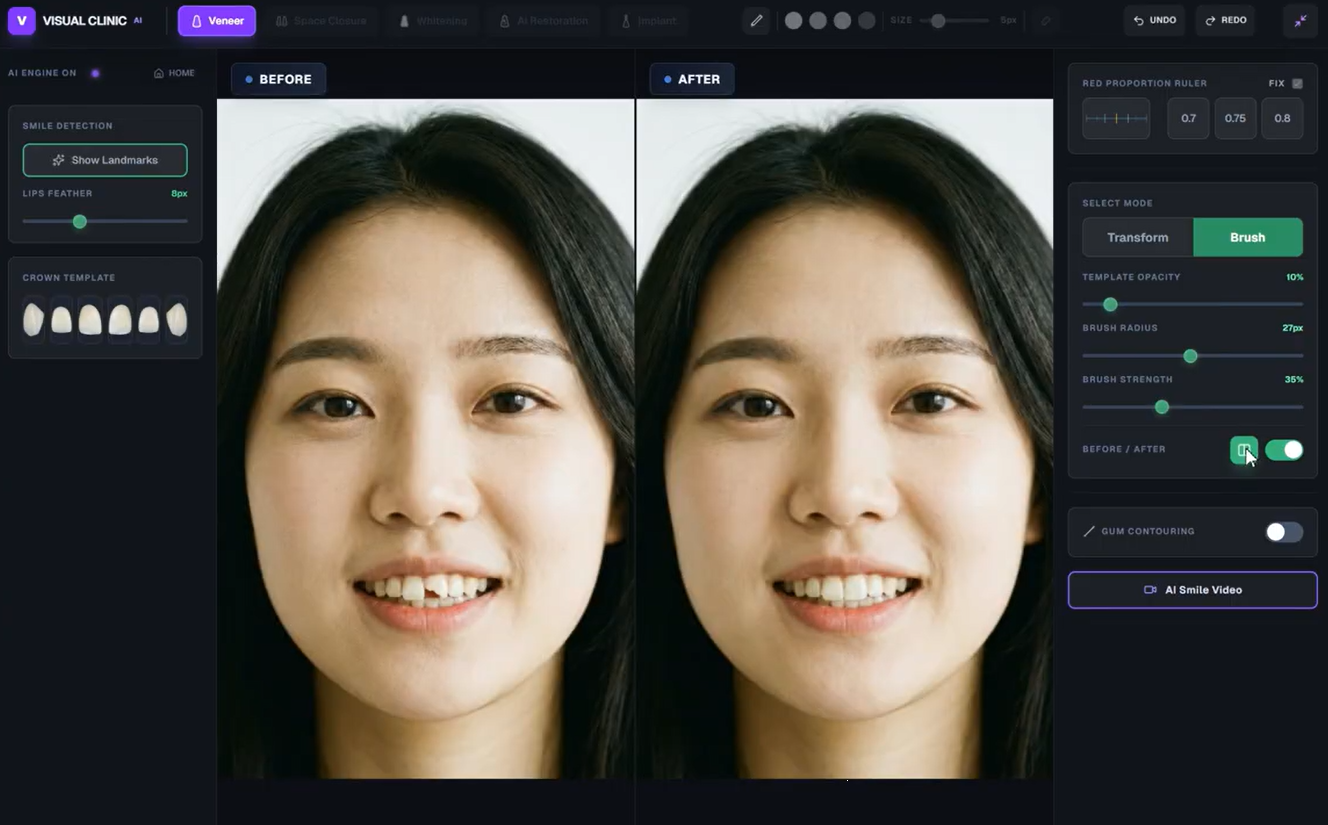 다양한 보존·보철 케이스
