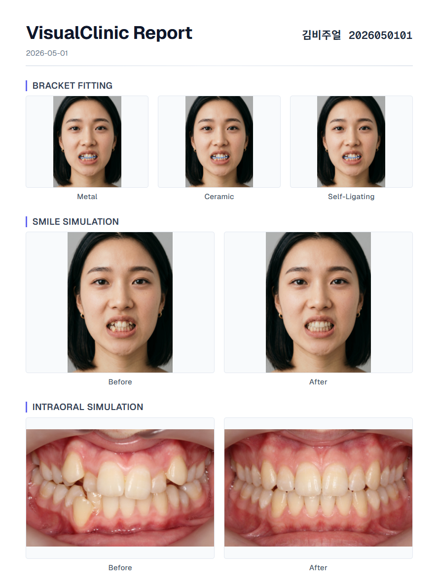 인쇄·PDF 가능한 요약